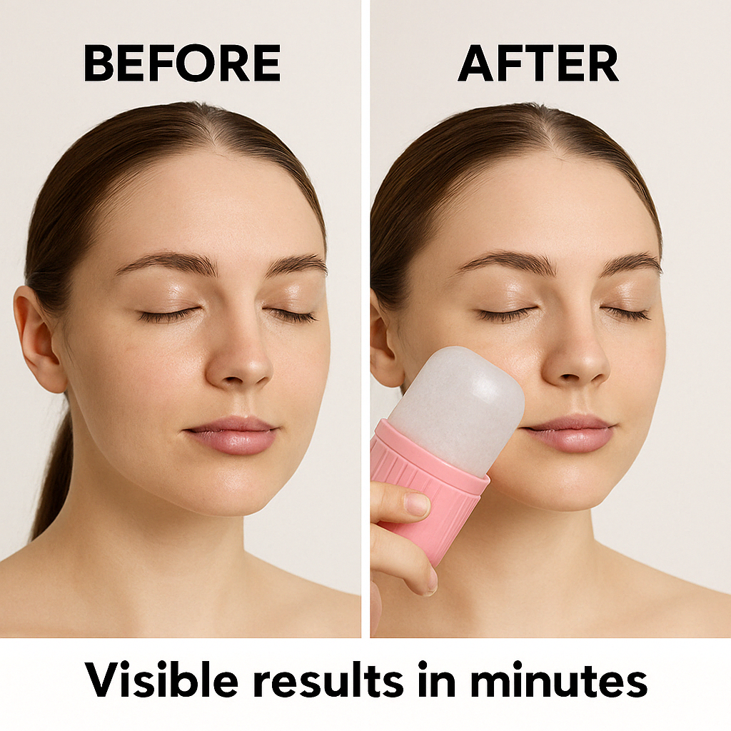 CHIC FASHION™-Ice Face Roller